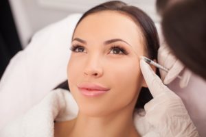 Combining Botox or Dysport with Dermal Fillers